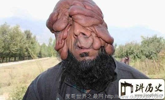 世界上最丑的男人，烏干達最丑男人取2個老婆生8個孩子